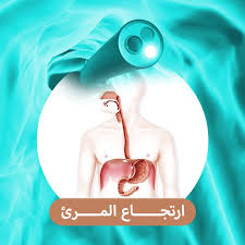 علاج-ارتجاع-المريء.jpeg