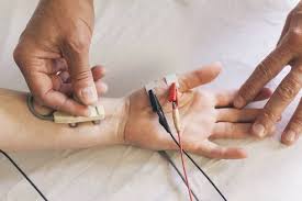 خطيط-الأعصاب-بدقة-وبساطة-MS.jpg